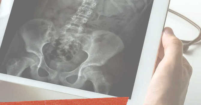 Enhancing the Chiropractic Scope image